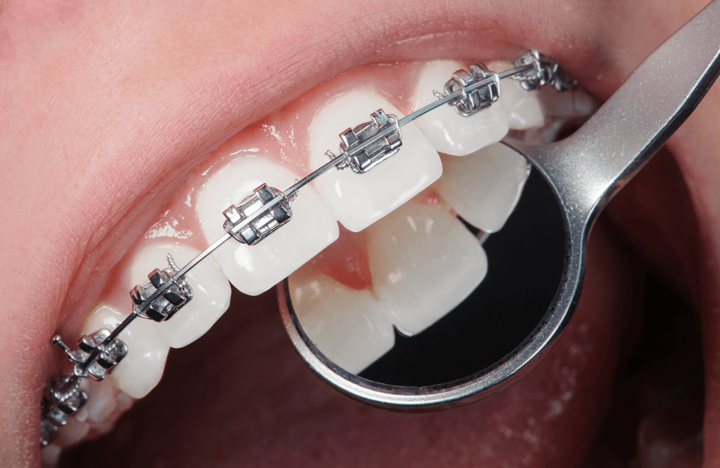 Ortodonţie Bacău